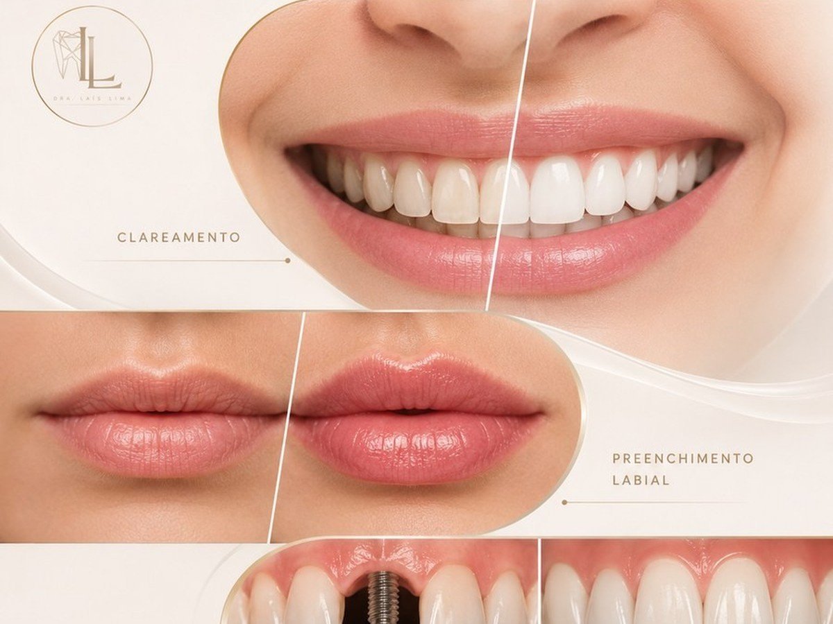 Planejamento estético do sorriso